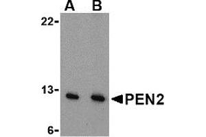 Western Blotting (WB) image for anti-Presenilin Enhancer 2 Homolog (PSENEN) (N-Term) antibody (ABIN1031508) (PEN2 anticorps  (N-Term))
