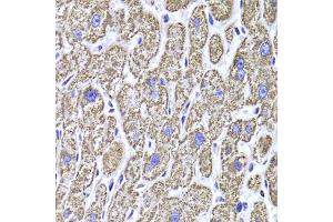 Immunohistochemistry of paraffin-embedded human liver injury using MDH2 Antibody (ABIN1980313) at dilution of 1:100 (40x lens). (MDH2 anticorps)
