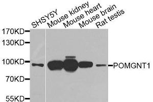 Western blot analysis of extracts of various cell lines, using POMGNT1 antibody. (POMGNT1 anticorps  (AA 411-660))