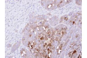 IHC-P Image Immunohistochemical analysis of paraffin-embedded NCIN87 xenograft , using PAI-2, antibody at 1:500 dilution.