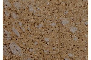ABIN6257084 and ABIN6273565 at 1/100 staining Rat brain tissue by IHC-P. (CPXCR1 anticorps  (N-Term))