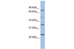 PPM1K antibody used at 1 ug/ml to detect target protein. (PPM1K anticorps)