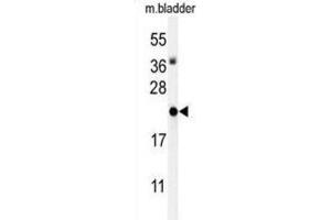 Western Blotting (WB) image for anti-Inhibitor of DNA Binding 4, Dominant Negative Helix-Loop-Helix Protein (ID4) antibody (ABIN3004406) (ID4 anticorps)