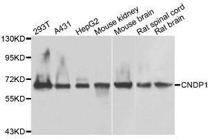Western blot analysis of extracts of various cell lines, using CNDP1 antibody. (CNDP1 anticorps)