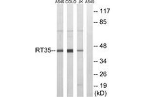 Western Blotting (WB) image for anti-Mitochondrial Ribosomal Protein S35 (MRPS35) (AA 211-260) antibody (ABIN2890043) (MRPS35 anticorps  (AA 211-260))