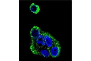 Image no. 2 for anti-Alcohol Dehydrogenase 1B (Class I), beta Polypeptide (ADH1B) (AA 216-245) antibody (ABIN452722)
