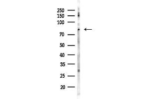 anti-Solute Carrier Family 5 Member 3 (SLC5A3) antibody