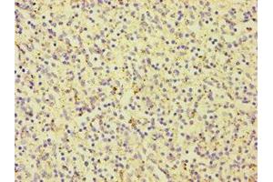 Immunohistochemistry of paraffin-embedded human spleen tissue using ABIN7146924 at dilution of 1:100 (CARD9 anticorps  (AA 237-536))