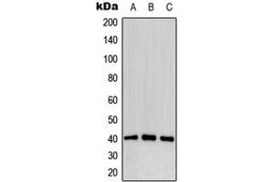 Western blot analysis of CD32b (pY292) expression in MCF7 pervanadate-treated (A), mouse liver (B), PC12 pervanadate-treated (C) whole cell lysates. (FCGR2B anticorps  (C-Term, pTyr292))