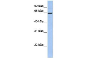 WB Suggested Anti-CCDC67 Antibody Titration: 0. (CCDC67 anticorps  (N-Term))