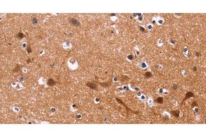 Immunohistochemistry of paraffin-embedded Human brain tissue using MSH4 Polyclonal Antibody at dilution 1:30 (MSH4 anticorps)