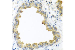 Immunohistochemistry of paraffin-embedded mouse lung using WNT5B antibody at dilution of 1:100 (40x lens). (WNT5B anticorps)
