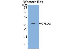 Western blot analysis of the recombinant protein. (CX3CL1 anticorps  (AA 83-330))