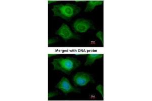 ICC/IF Image Immunofluorescence analysis of paraformaldehyde-fixed HeLa, using AKR1B10, antibody at 1:200 dilution.