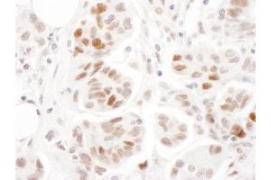 Immunohistochemistry (IHC) image for anti-Structural Maintenance of Chromosomes 1A (SMC1A) (pSer957) antibody (ABIN7453448) (SMC1A anticorps  (pSer957))