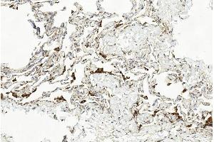 Immunohistochemical analysis of paraffin-embedded Human lung section using Pink1 am1851b. (LAMP2 anticorps)