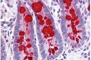 Human Small Intestine: Formalin-Fixed, Paraffin-Embedded (FFPE)