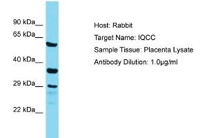 Host: Rabbit Target Name: IQCC Sample Tissue: Human Placenta Antibody Dilution: 1ug/ml (IQCC anticorps  (Middle Region))