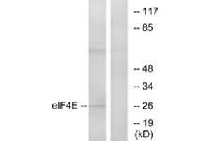 Western blot analysis of extracts from NIH-3T3 cells, treated with FBS, using eIF4E (Ab-209) Antibody. (EIF4E anticorps  (AA 168-217))
