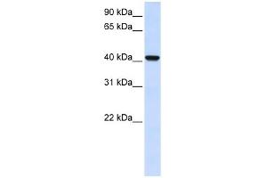 DGAT2L4 antibody used at 1 ug/ml to detect target protein. (AWAT2 anticorps  (C-Term))