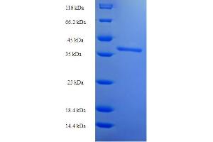 SDS-PAGE (SDS) image for Sialophorin (SPN) (AA 20-253) protein (His-SUMO Tag) (ABIN5710412)