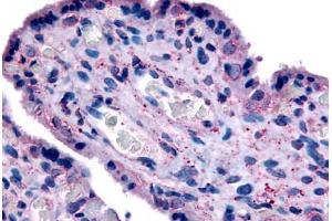 Human Placenta (formalin-fixed, paraffin-embedded) stained with SLC7A5 antibody ABIN213435 at 20 ug/ml followed by biotinylated goat anti-rabbit IgG secondary antibody ABIN481713, alkaline phosphatase-streptavidin and chromogen. (SLC7A5 anticorps  (N-Term))