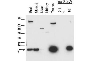 Image no. 1 for anti-Selenoprotein W, 1 (SEPW1) antibody (ABIN401399) (Selenoprotein W anticorps)