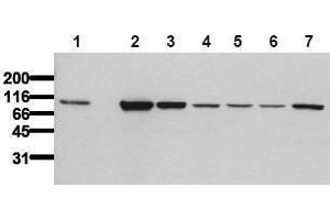 Western Blotting (WB) image for anti-Catenin (Cadherin-Associated Protein), beta 1, 88kDa (CTNNB1) (Exon 2), (N-Term) antibody (ABIN126745) (CTNNB1 anticorps  (Exon 2, N-Term))