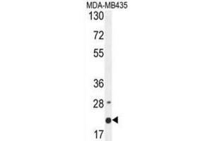 Western Blotting (WB) image for anti-Membrane-Spanning 4-Domains, Subfamily A, Member 4 (MS4A4A) antibody (ABIN2995855) (MS4A4A anticorps)