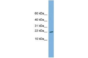 WB Suggested Anti-RPS13 Antibody Titration: 0. (RPS13 anticorps  (Middle Region))