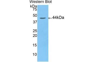 Detection of Recombinant ARRb2, Human using Polyclonal Antibody to Arrestin Beta 2 (ARRb2) (Arrestin 3 anticorps  (AA 262-430))