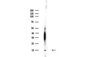 anti-Prefoldin Subunit 6 (PFDN6) (N-Term) antibody