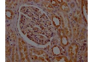 IHC image of ABIN7127782 diluted at 1:100 and staining in paraffin-embedded human kidney tissue performed on a Leica BondTM system.