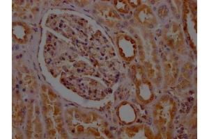 IHC image of ABIN7127782 diluted at 1:100 and staining in paraffin-embedded human kidney tissue performed on a Leica BondTM system. (Recombinant PTGER2 anticorps)