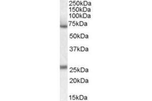 Image no. 2 for anti-Alpha2 Antiplasmin (SERPINF2) (Internal Region) antibody (ABIN375144) (alpha 2 Antiplasmin anticorps  (Internal Region))