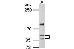 WB Image Sample (30 ug of whole cell lysate) A: BCL-1 5% SDS PAGE antibody diluted at 1:5000 (ATP2A3 anticorps  (N-Term))