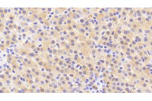 Detection of HMWK in Human Liver Tissue using Polyclonal Antibody to High Molecular Weight Kininogen (HMWK)