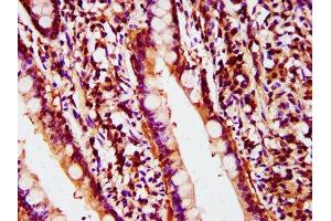 anti-Polymerase (DNA Directed), delta 2, Accessory Subunit (POLD2) (AA 245-430) antibody