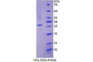 SDS-PAGE analysis of Mouse SOD2 Protein. (SOD2 Protéine)