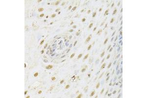 Immunohistochemistry of paraffin-embedded human esophagus using HDAC3 Antibody (ABIN5971166) at dilution of 1/100 (40x lens). (HDAC3 anticorps)