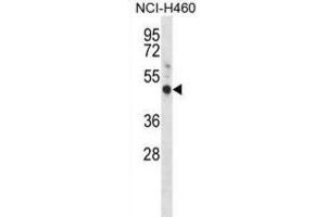 Western Blotting (WB) image for anti-G Protein-Coupled Estrogen Receptor 1 (GPER) antibody (ABIN2998385) (GPER anticorps)