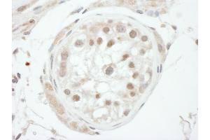 Immunohistochemistry (IHC) image for anti-General Transcription Factor IIH, Polypeptide 1, 62kDa (GTF2H1) (AA 250-300) antibody (ABIN7454921)
