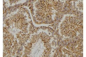ABIN6273478 at 1/100 staining  testis tissue by IHC-P. (CYLC2 anticorps  (C-Term))