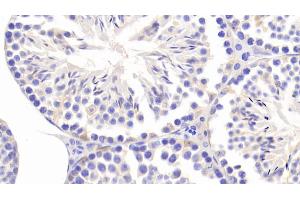Detection of CCDC60 in Mouse Testis Tissue using Polyclonal Antibody to Coiled Coil Domain Containing Protein 60 (CCDC60)