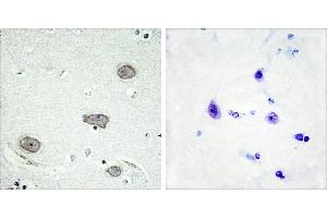 P-peptide - +Immunohistochemistry analysis of paraffin-embedded human brain tissue using CSFR (Phospho-Tyr809) antibody. (CSF1R anticorps  (pTyr809))