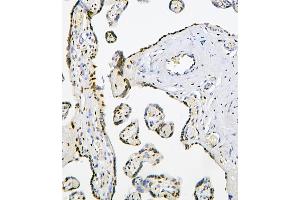 IHC analysis of PHF21A using anti-PHF21A antibody (ABIN6719353). (PHF21A anticorps  (AA 1-97))