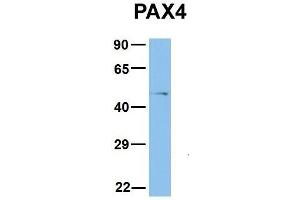 Host:  Rabbit  Target Name:  PAX4  Sample Type:  COLO205  Antibody Dilution:  1. (PAX4 anticorps  (Middle Region))