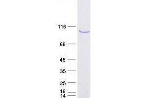 Validation with Western Blot
