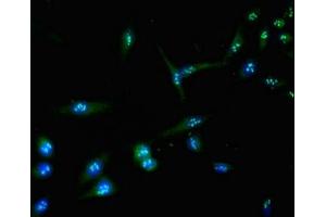 Immunofluorescent analysis of Hela cells using ABIN7145083 at dilution of 1:100 and Alexa Fluor 488-congugated AffiniPure Goat Anti-Rabbit IgG(H+L)