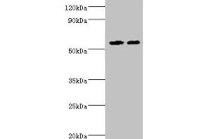 Western blot All lanes: ALDH4A1 antibody at 13 μg/mL Lane 1: K562 whole cell lysate Lane 2: 293T whole cell lysate Secondary Goat polyclonal to rabbit IgG at 1/10000 dilution Predicted band size: 62, 56, 57 kDa Observed band size: 62 kDa (ALDH4A1 anticorps  (AA 354-563))